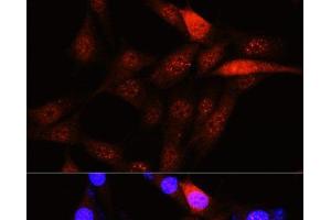 Immunofluorescence analysis of NIH-3T3 cells using PLK1 Polyclonal Antibody at dilution of 1:100 (40x lens). (PLK1 antibody)