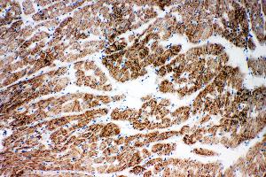 Anti-NDUFA1 antibody, IHC(F) IHC(F): Rat Cardiac Muscle Tissue
