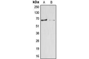 Western blot analysis of Arylsulfatase E expression in HepG2 (A), HEK293T (B) whole cell lysates. (Arylsulfatase E antibody  (Center))