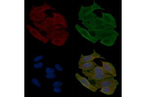 ABIN6262729 and ABIN6278925 staining Hela cells(30 min of UV treatment) by IF/ICC. (Keratin 6 antibody  (C-Term))