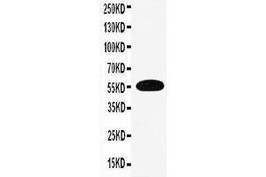 Anti-EAAT3 antibody,  Western blotting WB: Human Placenta Tissue Lysate (SLC1A1 antibody  (N-Term))