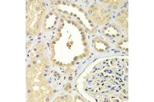 Immunohistochemistry of paraffin-embedded human kidney using ZNF346 antibody (ABIN5971759) at dilution of 1/100 (40x lens). (ZNF346 antibody)