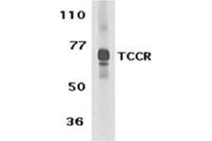 Western blot analysis of TCCR expression in human spleen tissue lysate with this product at 1 μg /ml. (IL27 Receptor alpha antibody  (C-Term))