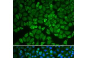 Immunofluorescence analysis of A549 cells using GSS Polyclonal Antibody (Glutathione Synthetase antibody)