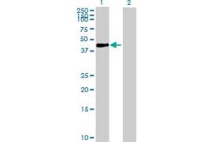 Western Blot analysis of ADA expression in transfected 293T cell line by ADA MaxPab polyclonal antibody. (ADA antibody  (AA 1-363))