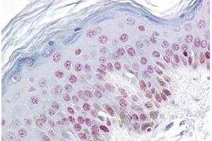 Human Skin: Formalin-Fixed, Paraffin-Embedded (FFPE) (RBM3 antibody  (AA 1-81))