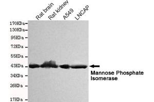 Western blot detection of Mannose Phosphate Isomerase in Rat kidney,Rat brain,A549 and Lncap cell lysates and using Mannose Phosphate Isomerase mouse mAb (1:1000 diluted). (MPI antibody)