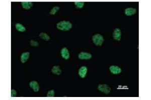 Immunostaining analysis in HeLa cells. (CBP antibody)