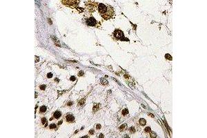 Immunohistochemical analysis of ASF1B staining in human testis formalin fixed paraffin embedded tissue section. (ASF1B antibody)