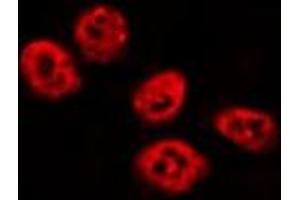 ABIN6275834 staining HepG2 by IF/ICC. (TBX3 antibody  (Internal Region))