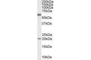 ABIN2561440 (1µg/ml) staining of HeLa cell lysate (35µg protein in RIPA buffer). (BMPR1A antibody  (Internal Region))