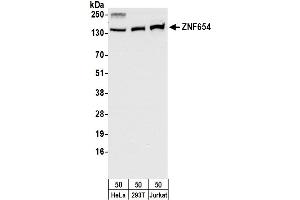 Western Blotting (WB) image for anti-Zinc Finger Protein 654 (ZNF654) (AA 477-527) antibody (ABIN7450949)