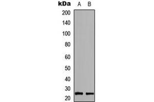 Western blot analysis of RAB39B expression in MCF7 (A), H9C2 (B) whole cell lysates. (RAB39B antibody  (Center))