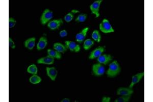 Immunofluorescence staining of A549 cells with ABIN7170348 at 1:200, counter-stained with DAPI. (SNX12 antibody  (AA 2-172))
