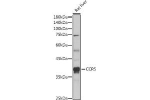 Western blot analysis of extracts of Rat liver, using CCR5 antibody (ABIN7266307) at 1:1000 dilution. (CCR5 antibody  (AA 100-200))