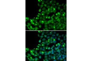 Immunofluorescence analysis of U20S cell using MGMT antibody. (MGMT antibody  (AA 1-207))
