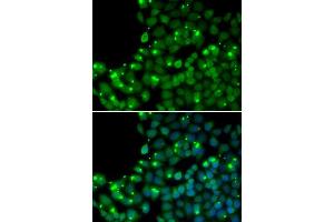 Immunofluorescence analysis of U20S cell using MGMT antibody. (MGMT antibody  (AA 1-207))