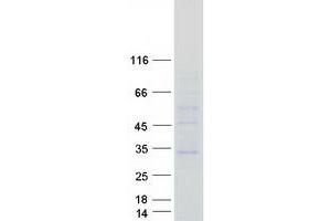 Validation with Western Blot