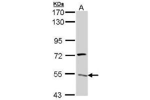 WB Image Sample (30 ug of whole cell lysate) A: Hela 7. (ATP6V1H antibody  (Center))