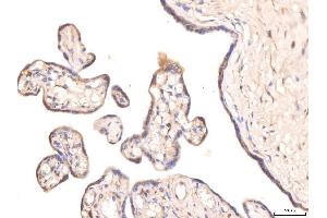 IHC analysis of KCNQ1 using anti-KCNQ1 antibody (ABIN4886647).
