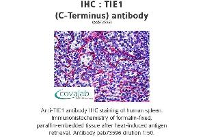 Image no. 1 for anti-tyrosine Kinase with Immunoglobulin-Like and EGF-Like Domains 1 (TIE1) (C-Term) antibody (ABIN1740068) (TIE1 antibody  (C-Term))