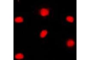 Immunofluorescent analysis of RB1 (pS795) staining in WERI cells. (Retinoblastoma 1 antibody  (C-Term, pSer795))