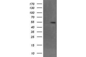 Image no. 8 for anti-Makorin Ring Finger Protein 1 (MKRN1) antibody (ABIN1499486)