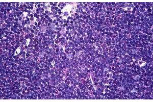 Human Thymus: Formalin-Fixed, Paraffin-Embedded (FFPE) (CD58 antibody  (AA 1-241))