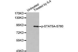 Western blot analysis of extracts from K562 cells using Phospho-STAT5A-S780 antibody. (STAT5A antibody  (pSer780))