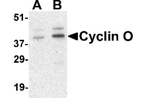 Western blot analysis of UNG2 in human bladder tissue lysate with UNG2 antibody at (A) 1 and (B) 2 µg/mL. (Cyclin O antibody  (Middle Region))