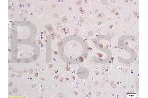 Formalin-fixed and paraffin embedded rat brain labeled with Anti-CLCN3 Polyclonal Antibody, Unconjugated (ABIN1386131) at 1:200 followed by conjugation to the secondary antibody and DAB staining (CLCN3 antibody  (AA 81-180))