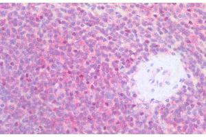 Immunohistochemistry staining of human spleen (paraffin-embedded sections) with anti-CD79b (CB3-1), 10 μg/mL. (CD79b antibody)