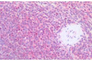 Immunohistochemistry staining of human spleen (paraffin-embedded sections) with anti-CD79b (CB3-1), 10 μg/mL.