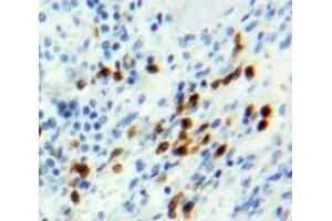 Used in DAB staining on fromalin fixed paraffin-embedded Spleen tissue (Retinoblastoma 1 antibody  (AA 639-778))