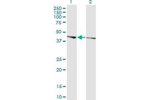 Western Blot analysis of PHACTR3 expression in transfected 293T cell line by PHACTR3 monoclonal antibody (M02), clone 4A5. (PHACTR3 antibody  (AA 92-179))