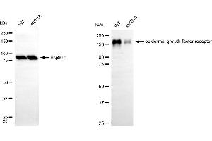 Western blotting analysis using epidermal growth factor receptor antibody (ABIN7798473). (EGFR antibody)