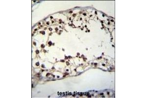 PIH1D2 Antibody (C-term) (ABIN655237 and ABIN2844841) immunohistochemistry analysis in formalin fixed and paraffin embedded human testis tissue followed by peroxidase conjugation of the secondary antibody and DAB staining. (PIH1D2 antibody  (C-Term))