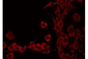 ABIN6268754 staining HeLa by IF/ICC. (TOMM20 antibody  (Internal Region))