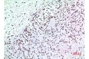Immunohistochemistry (IHC) analysis of paraffin-embedded Human Brain, antibody was diluted at 1:100. (P57 (Ser24) antibody)