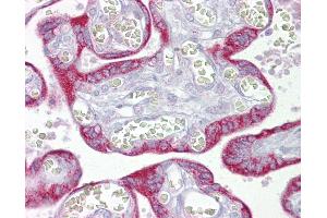 Anti-TFAM antibody IHC of human placenta. (TFAM antibody  (AA 151-200))