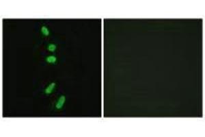 Immunofluorescence analysis of HeLa cells, using SF1 (Ab-82) antibody. (Splicing Factor 1 antibody  (Ser82))