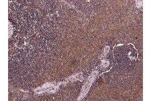Immunohistochemistry (IHC) image for anti-Prolyl 4-Hydroxylase, alpha Polypeptide I (P4HA1) (Internal Region) antibody (ABIN190847)