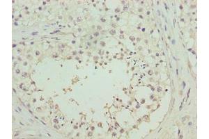 Immunohistochemistry of paraffin-embedded human testis tissue using ABIN7166851 at dilution of 1:100 (RHPN1-AS1 antibody  (AA 1-59))