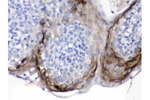 Elafin/Skalp was detected in paraffin-embedded sections of human tonsil tissues using rabbit anti- Elafin/Skalp Antigen Affinity purified polyclonal antibody (Catalog # ) at 1 µg/mL. (PI3 antibody  (AA 61-117))