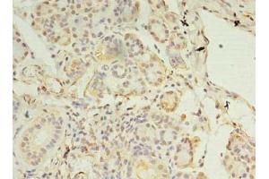 Immunohistochemistry of paraffin-embedded human pancreatic tissue using ABIN7146318 at dilution of 1:100 (CCDC109B antibody  (Regulatory Subunit))