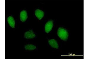 Immunofluorescence of purified MaxPab antibody to SFMBT1 on HeLa cell. (SFMBT1 antibody  (AA 1-866))