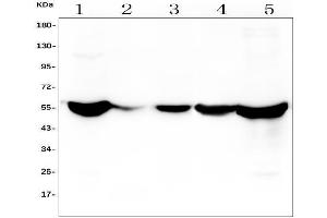 Western blot analysis of ALDH2 using anti-ALDH2 antibody (ABIN7603107). (ALDH2 antibody  (N-Term))