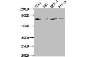 Western Blot Positive WB detected in: K562 whole cell lysate, U87 whole cell lysate, MCF-7 whole cell lysate, Rat brain tissue All lanes: LMNA antibody at 1:2000 Secondary Goat polyclonal to rabbit IgG at 1/50000 dilution Predicted band size: 75, 66, 71, 64, 63, 70 kDa Observed band size: 75 kDa