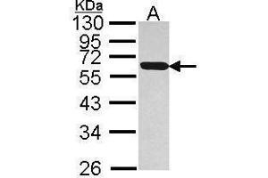 WB Image Sample (30 ug of whole cell lysate) A: Hep G2 , 12% SDS PAGE antibody diluted at 1:1000 (PDIA5 antibody)
