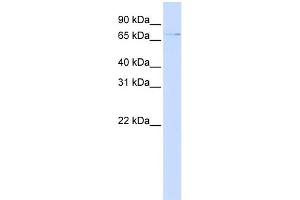 WB Suggested Anti-ZNF324 Antibody Titration:  0. (ZNF324 antibody  (N-Term))